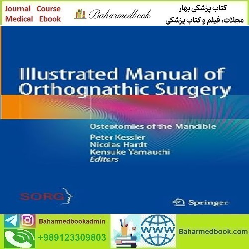 Illustrated Manual of Orthognathic Surgery Osteotomies of
