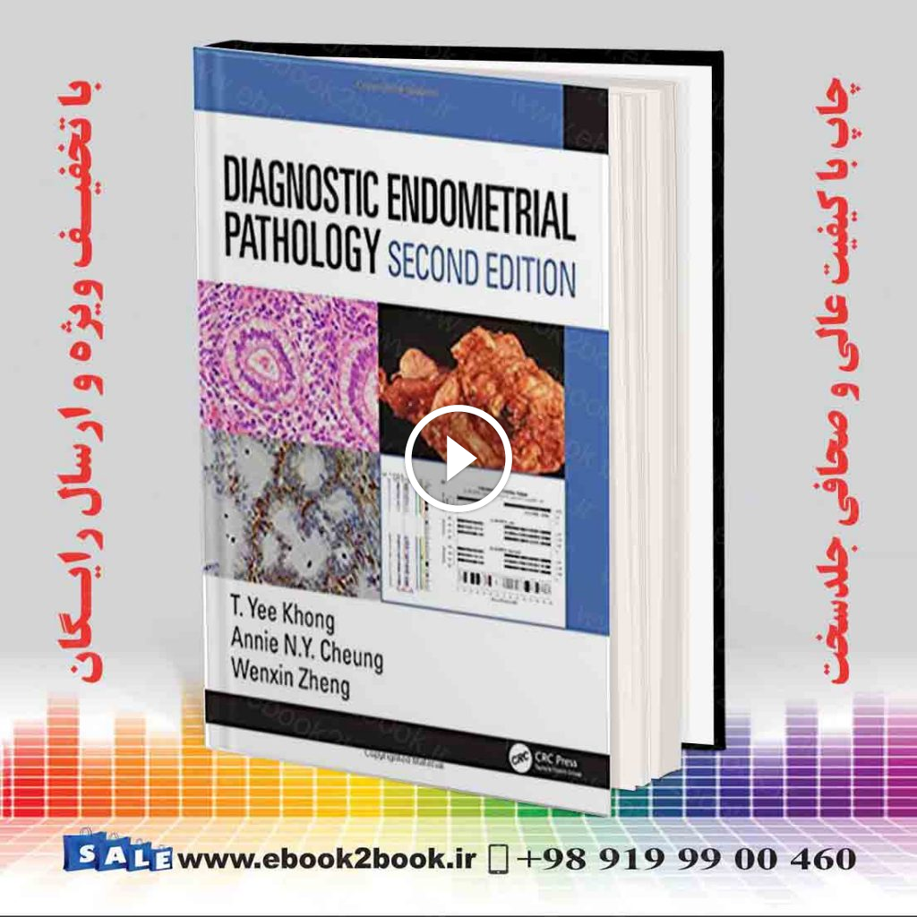 Diagnostic Endometrial Pathology 2nd Edition