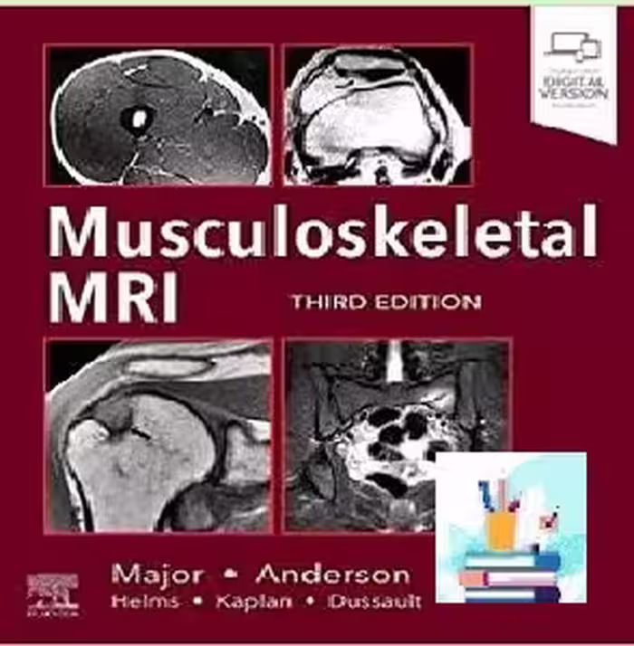Musculoskeletal MRI TRUE PDF price 1€