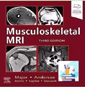 Musculoskeletal MRI TRUE PDF price 1€