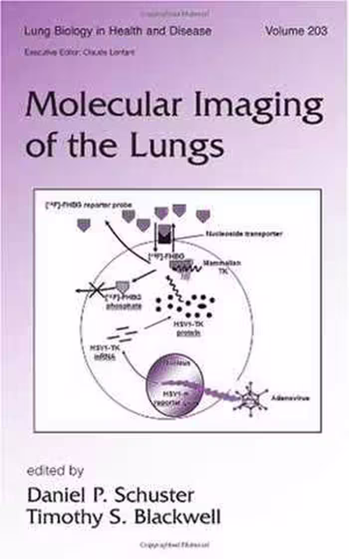 [PDF] دانلود کتاب Molecular Imaging Of The Lungs, 2005