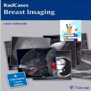 Breast Imaging TRUE PDF price 1€