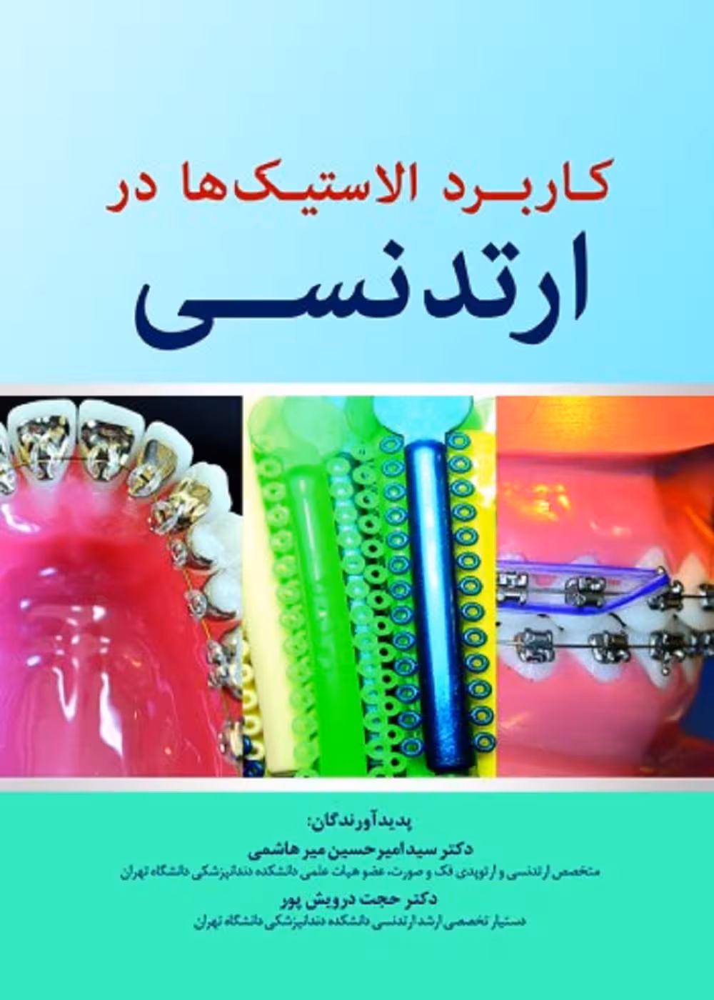 کاربرد الاستیک ها در ارتدنسی