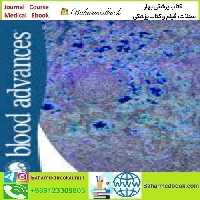 Blood Advances Volume 7 Issue 1 to 23 2023 TRUE PDF price 23€ - کتاب پزشکی بهار