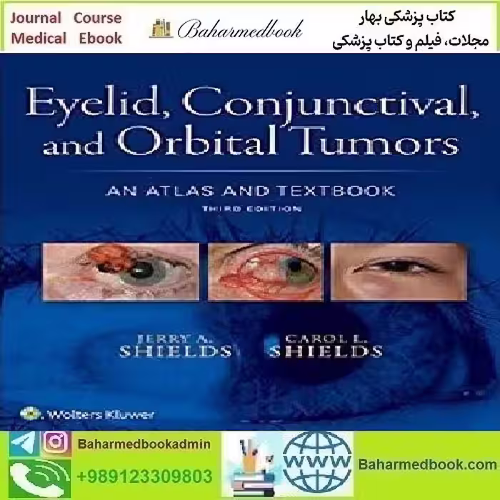 Eyelid Conjunctival and Orbital Tumors 2016 TRUE PDF price 1€ - کتاب پزشکی بهار