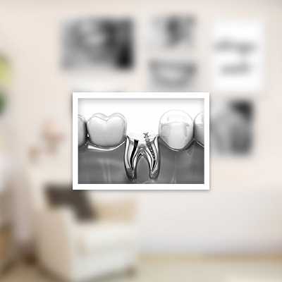 تابلو بکلیت طرح لبخند دندان پزشکی مدل W-908 مجموعه 7 عددی