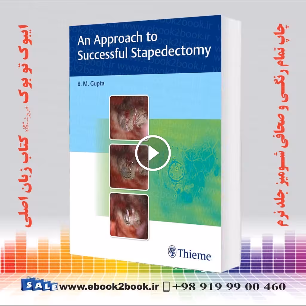 An Approach to Successful Stapedectomy