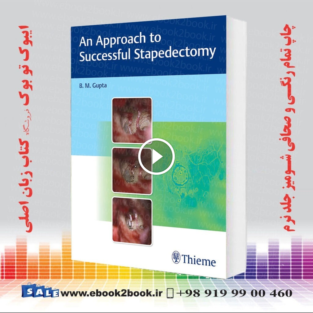 An Approach to Successful Stapedectomy