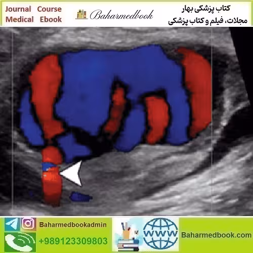 Clinical Ultrasound Review 2017 video course price 30€ - کتاب پزشکی بهار
