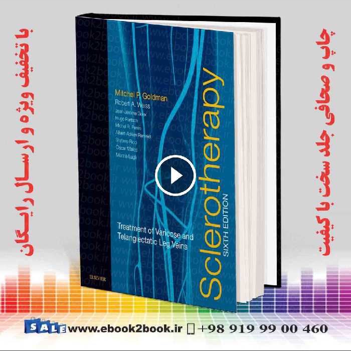Sclerotherapy 6th Edition