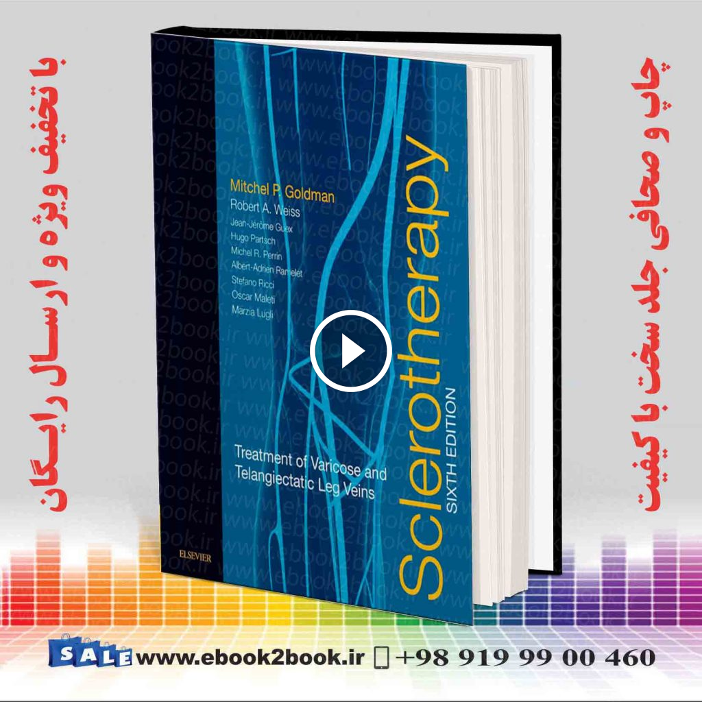Sclerotherapy 6th Edition