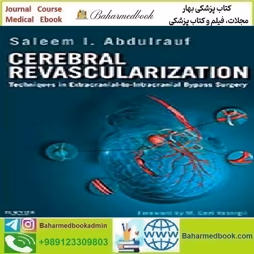 Cerebral Revascularization Techniques in Extracranial to Intracra