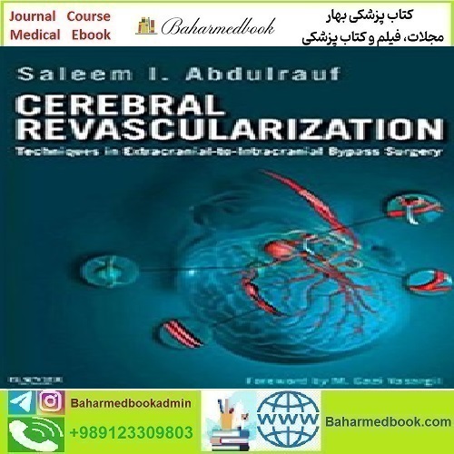 Cerebral Revascularization Techniques in Extracranial to Intracra