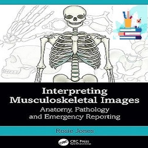 Interpreting Musculoskeletal Images Anatomy Pathology and Emergency Reporting TRUE PDF price 1€ - کتاب پزشکی بهار
