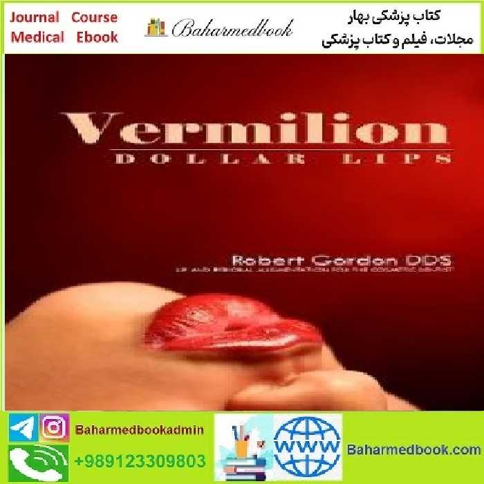 Vermilion Dollar Lips TRUE PDF price 1€ - کتاب پزشکی بهار