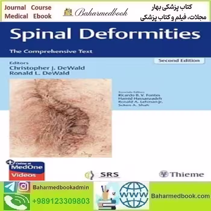 Spinal Deformities The Comprehensive Text 2024 TRUE PDF