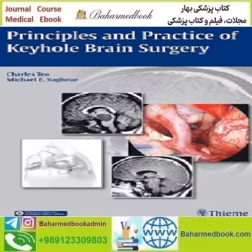 Principles and Practice of Keyhole Brain Surgery 2015 TR