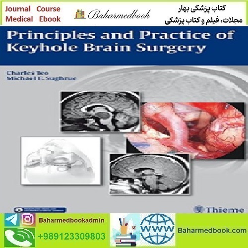 Principles and Practice of Keyhole Brain Surgery 2015 TR