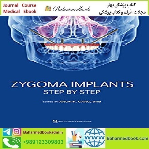 Zygoma Implants Step by Step 2023 TRUE PDF price 5€ - کتاب پزشکی بهار