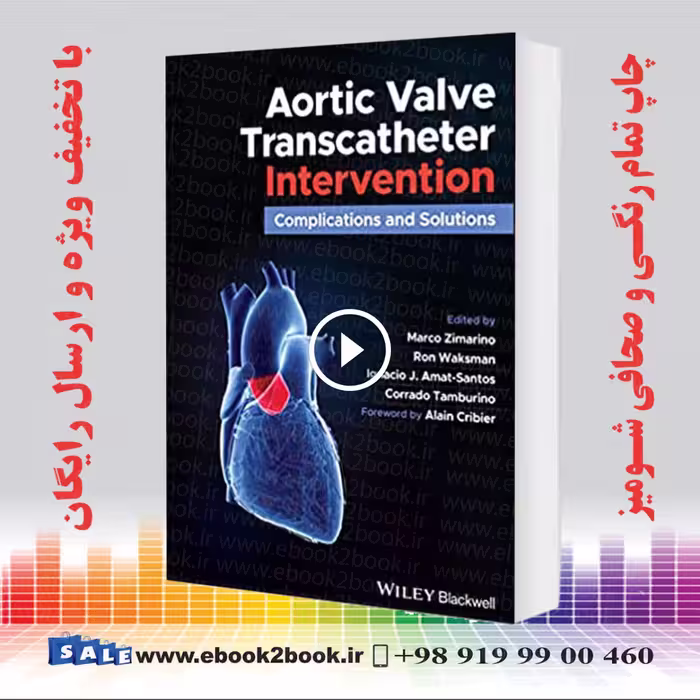 Aortic Valve Transcatheter Intervention