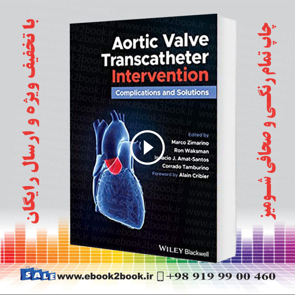 Aortic Valve Transcatheter Intervention
