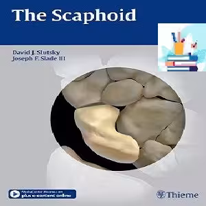 The Scaphoid 1ed PDF Video at 2€ - کتاب پزشکی بهار
