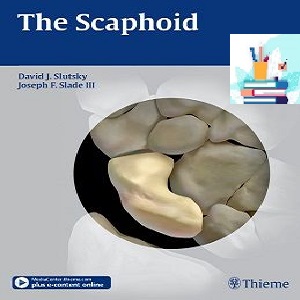 The Scaphoid 1ed PDF Video at 2€ - کتاب پزشکی بهار