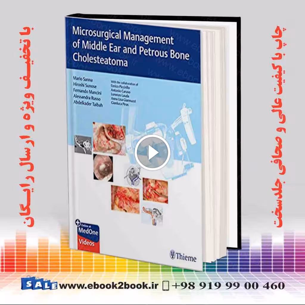 Microsurgical Management of Middle Ear and Petrous Bone Cholesteatoma