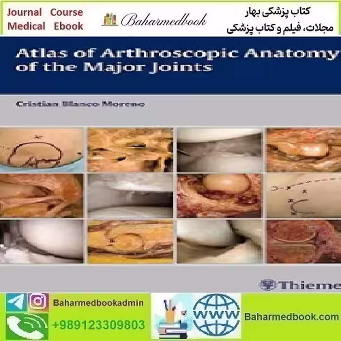 Atlas of Arthroscopic Anatomy of Major Joints 2016 TR