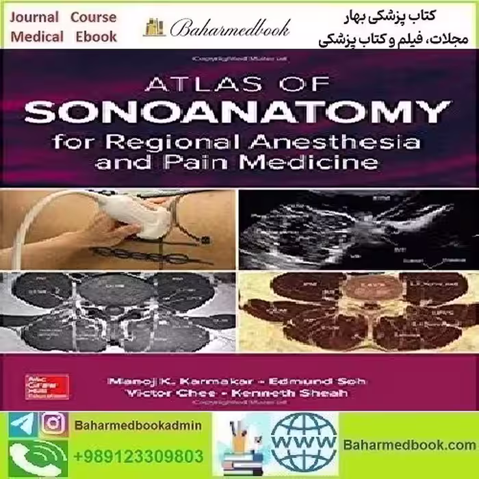 Atlas of Sonoanatomy for Regional Anesthesia and Pain Medicine