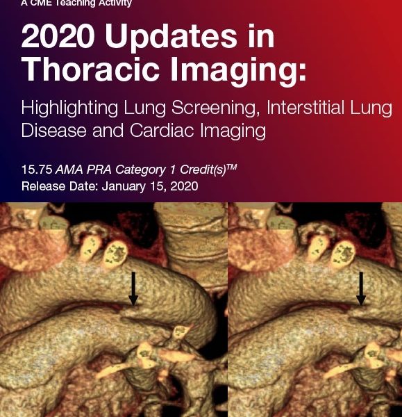 فیلمهای آموزشی 2020 Updates in Thoracic Imaging: Highlighting Lung Screening, Interstitial Lung Disease, and Cardiac Imaging – A Video CME Teaching Activity - کتاب پزشکی بهار