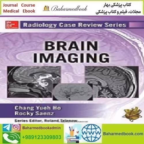 Radiology Case Review Series Brain Imaging 2015 TRUE