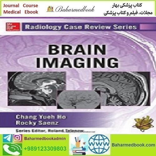 Radiology Case Review Series Brain Imaging 2015 TRUE