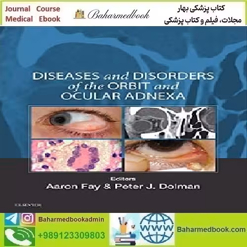 Diseases and Disorders of the Orbit and Ocular Adnexa 2017