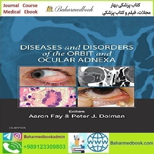 Diseases and Disorders of the Orbit and Ocular Adnexa 2017