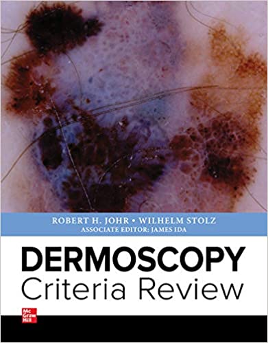 Dermoscopy Criteria Review 2020 - کتاب پزشکی بهار
