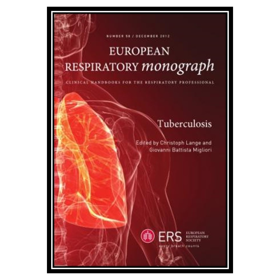 کتاب Tuberculosis اثر Christoph Lange and Giovanni Battista Migliori انتشارات مؤلفین طلایی