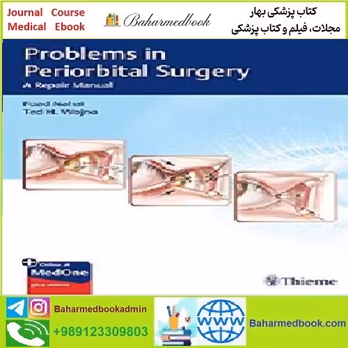 Problems in Periorbital Surgery TRUE PDF price 1€