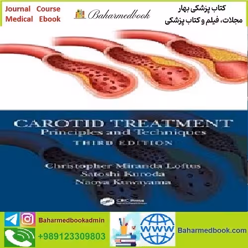 Carotid Treatment TRUE PDF price 1€ - کتاب پزشکی بهار