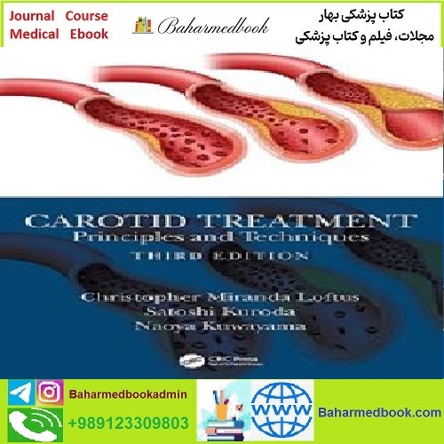 Carotid Treatment TRUE PDF price 1€ - کتاب پزشکی بهار