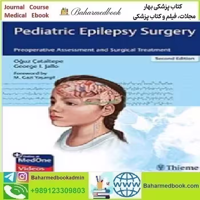 Pediatric Epilepsy Surgery Preoperative Assessment and Surgic