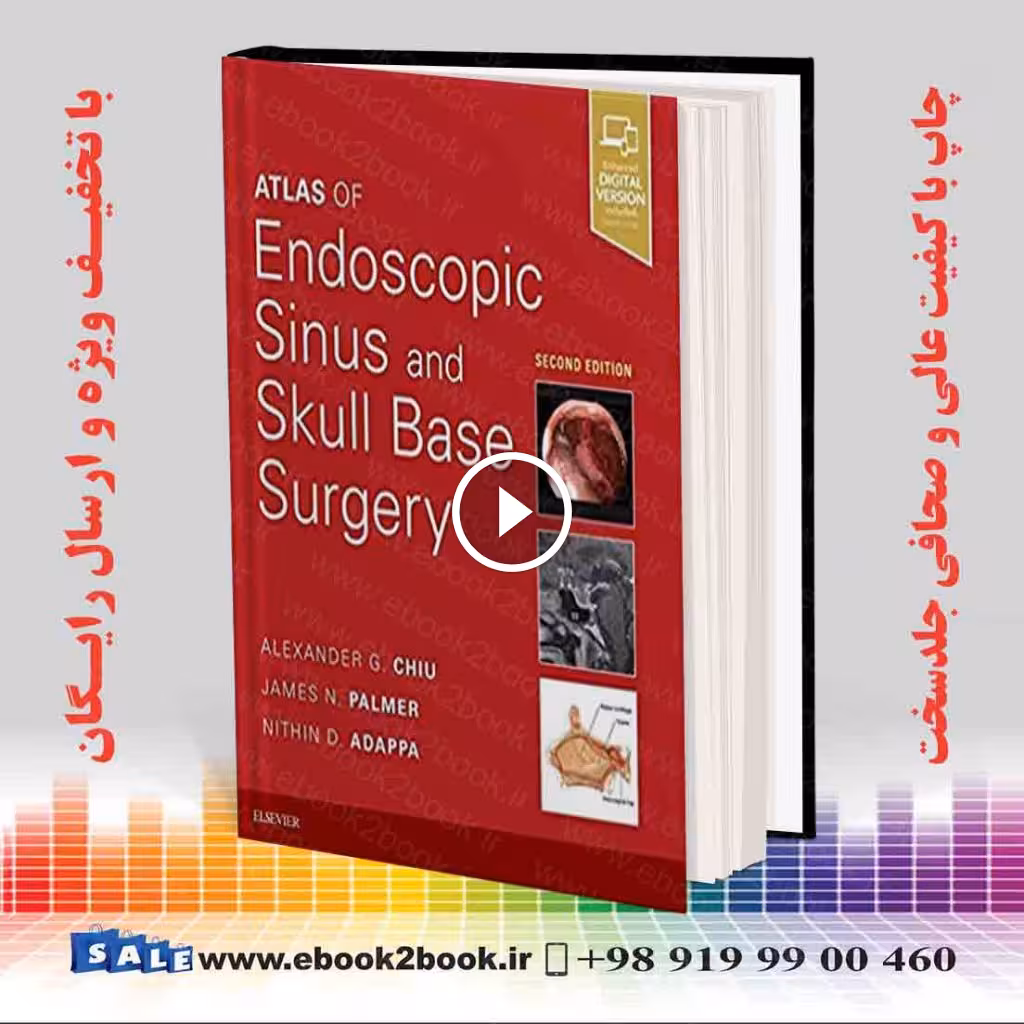 Atlas of Endoscopic Sinus and Skull Base Surgery 2nd Edition