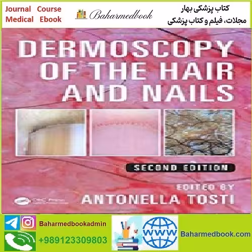 Dermoscopy of the Hair and Nails TRUE PDF price 1€ - کتاب پزشکی بهار