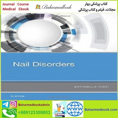 Nail Disorders TRUE PDF price 1€ - کتاب پزشکی بهار
