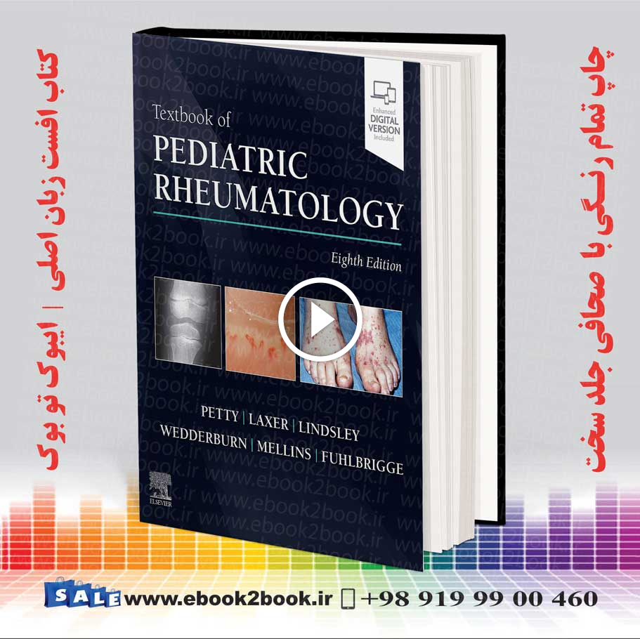 Textbook of Pediatric Rheumatology 8th Edition