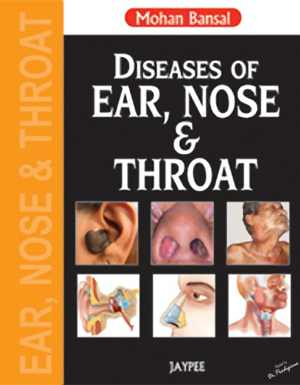 [PDF] دانلود کتاب Diseases Of Ear, Nose And Throat, 2013