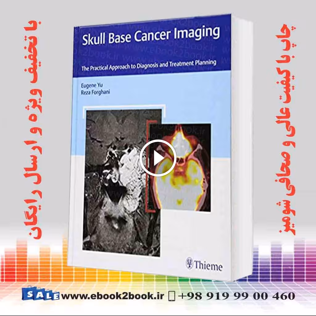 Skull Base Cancer Imaging: The Practical Approach to Diagnosis and Treatment Planning