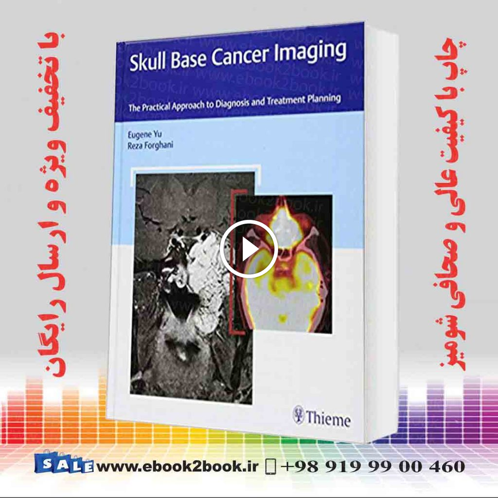 Skull Base Cancer Imaging: The Practical Approach to Diagnosis and Treatment Planning