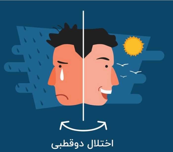 تحقیق در مورد اختلال دوقطبی