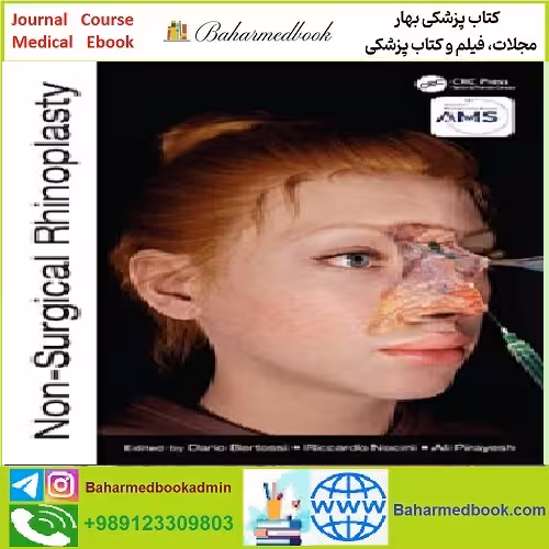 Non Surgical Rhinoplasty TRUE PDF price 1€